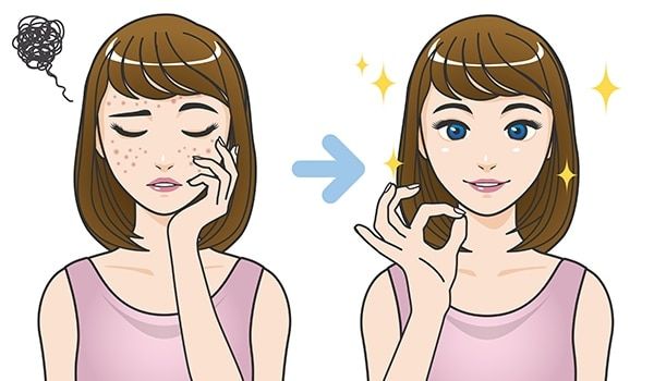 How to Reduce Acne Naturally at Home: Simple Remedies That Actually Help After Skincare