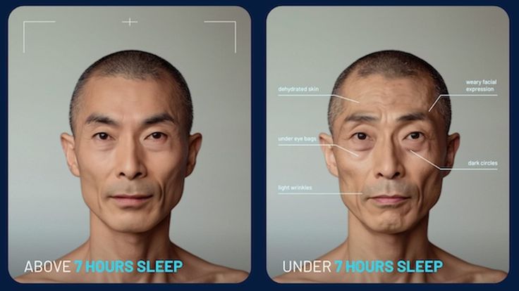 IMPACT OF LACK OF SLEEP